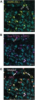 Myelination Deficits in the Auditory Brainstem of a Mouse Model of Fragile X Syndrome